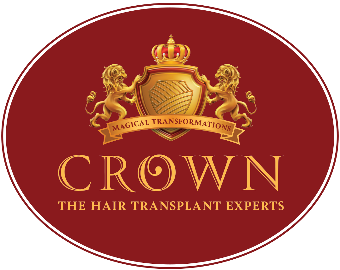 Crown Hair Transplant