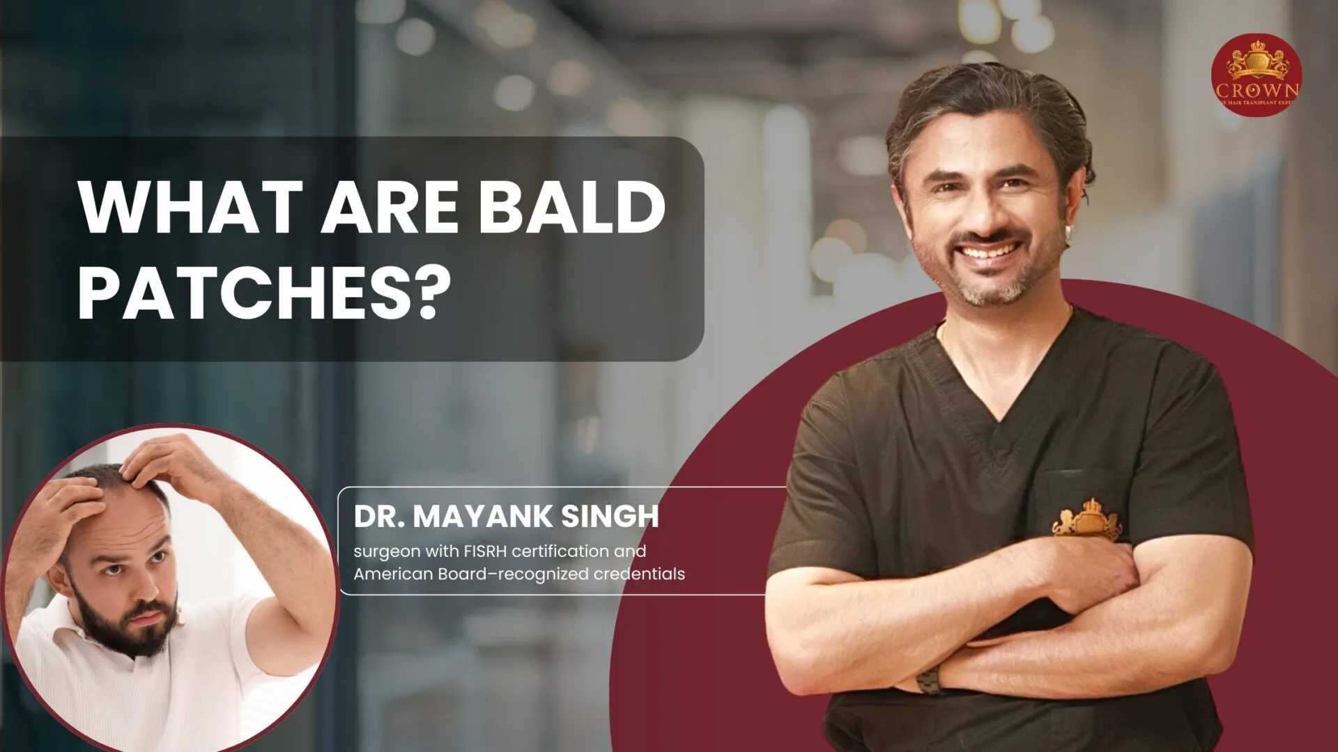 What Are Bald Patches?