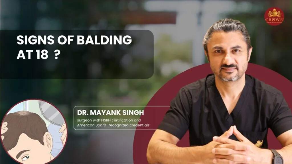 Signs of Balding at 18?
