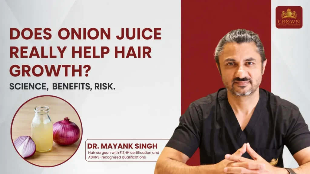 Hair loss expert explaining the science behind onion juice for hair growth, hair fall treatment, benefits, risks, and clinical evidence.