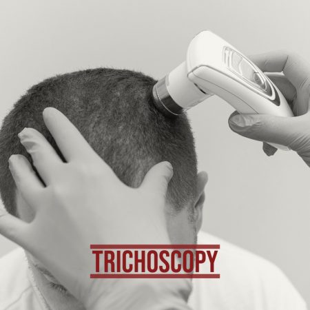 clinical-examination-and-trichoscopy-988x1000-2.jpg